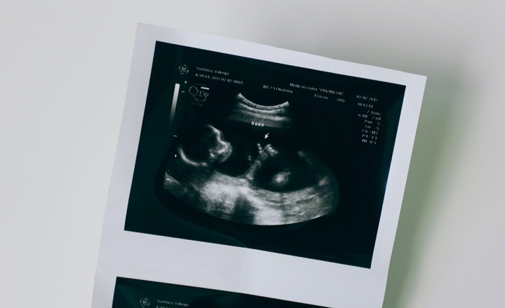 An ultrasound scan